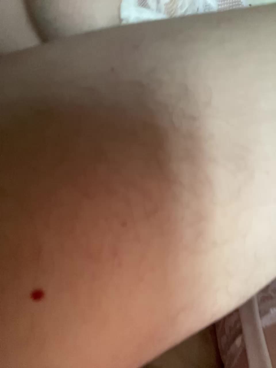 Essss33331 Adult Chat March 9, 2026