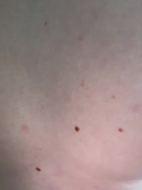 _M_O_L_O_K_O_ Adult Chat March 23, 2026